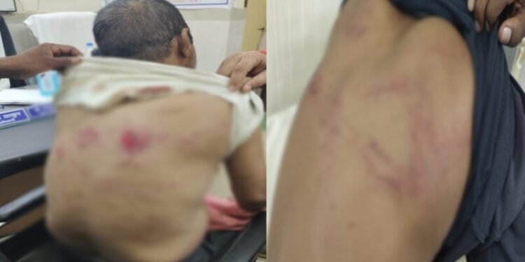 CG News : अतिक्रमण हटाने गए डिप्टी रेंजर समेत पांच कर्मियों को बनाया बंधक, पुलिस ने छुड़ाया…