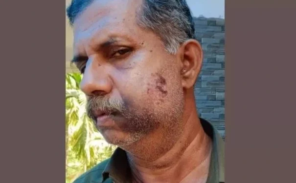 गजब की दुश्मनी, स्कूल में पढ़ाई के वक्त चौथी क्लास में हुआ था झगड़ा, 50 साल बाद लिया बदला, तोड़​ दिए दांत