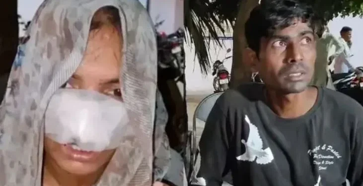 Viral News : प्रेमी के साथ पत्नी को देख गुस्साए पति ने दांत से काटकर अलग कर दी नाक, अस्पताल लेकर पहुंचा लवर