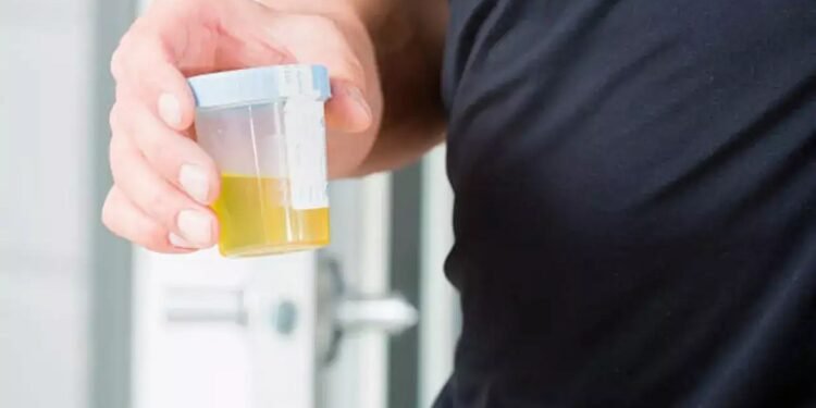 Urine Eye Wash: आंखों को यूरिन से धोने से ठीक हो जाती हैं कई बीमारियां! इस महिला ने खुद किया ट्राई, सोशल मीडिया पर वायरल हुआ वीडियो