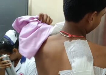 CG – स्कूल में गैंगवार : स्कूली छात्रों के बीच हिंसक झड़प, छात्र ने साथी पर किया ब्लेड से वार, गंभीर हालत में ले जाया गया अस्पताल