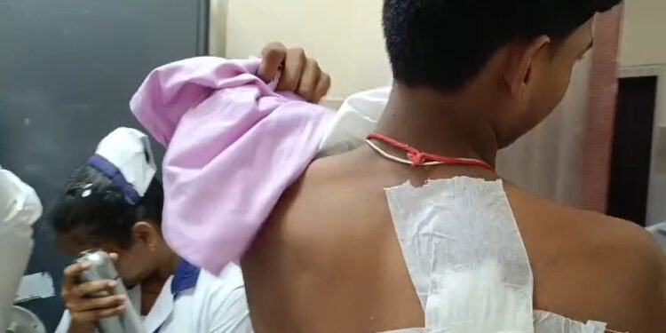 CG – स्कूल में गैंगवार : स्कूली छात्रों के बीच हिंसक झड़प, छात्र ने साथी पर किया ब्लेड से वार, गंभीर हालत में ले जाया गया अस्पताल