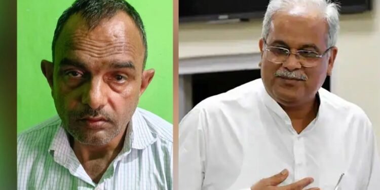 CG : भाजपा नेता ने मांगी इच्छा मृत्यु, इलाज की जिम्मेदारी लेंगे पूर्व मुख्यमंत्री भूपेश बघेल, पीएम मोदी की सभा के दौरान हुआ था हादसा