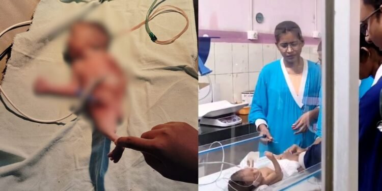 छत्तीसगढ़ में जन्मा ‘जलपरी’ जैसा शिशु, अद्भुत रूप देख दंग रह गए डॉक्टर, फिर जन्म के कुछ ही देर बाद कांप उठे लोग देखे पूरा वीडियो