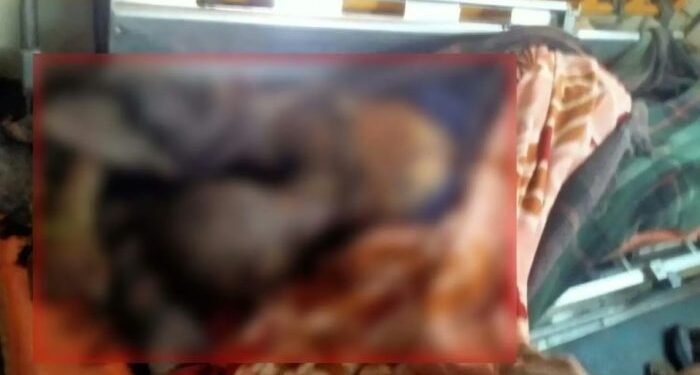 CG : बस के ड्राइवर ने खुद पर डीजल डालकर लगाई आग, उपचार के दौरान मौत, माइंस बस में करता था ड्यूटी