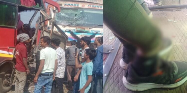 CG Road Accident : यात्री बस और ट्रक के बीच जोरदार भिड़ंत, चालक का टूटा पैर, कई लोग बुरी तरह हुए घायल