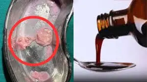 CG Breaking : सीरप की बोतल में संदिग्ध वस्तु मिलने का मामला, जांच के लिए नमूने भेजे गए राज्य औषधि परीक्षण प्रयोगशाला