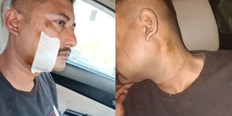 CG Crime : शराबी ASI को पत्नी के पीटा, धारदार हथियार से हमला कर किया घायल, कहा नशे में बेटी के साथ कर रहा था ….