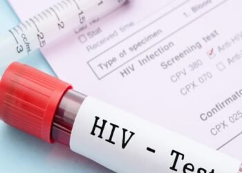 जिले में HIV विस्फोट 7400 पहुंची एचआईवी पॉजिटिव मरीजों की संख्या, स्वास्थ्य महकमे में मचा हड़कंप पढ़े पूरा डिटेल