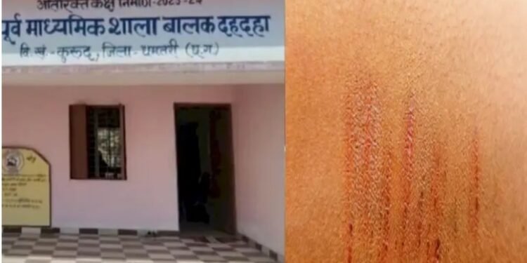 CG News : सरकारी स्कूल के 35 बच्चों ने ब्लेड से काटी कलाई, अब प्राचार्य और HM को शिक्षा विभाग ने नोटिस जारी कर मांगा जवाब