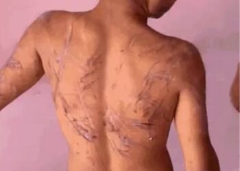 CG News : …. इस नशा मुक्ति केंद्र में संचालिका का बेटा बना हैवान, मरीज के साथ की जमकर मारपीट, वायरल हुआ वीडियो