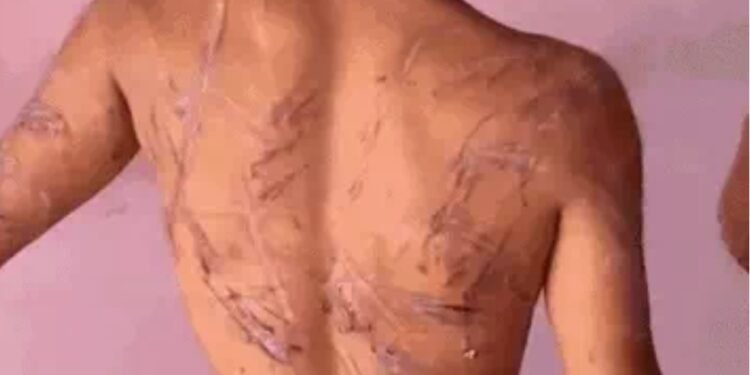 CG News : …. इस नशा मुक्ति केंद्र में संचालिका का बेटा बना हैवान, मरीज के साथ की जमकर मारपीट, वायरल हुआ वीडियो