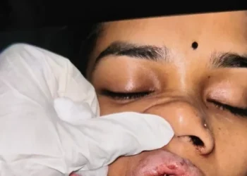 CG News : चलती कार में जमकर पथराव, कार सवार महिला बुरी तरह से जख्मी, एमपी जा रहा था परिवार