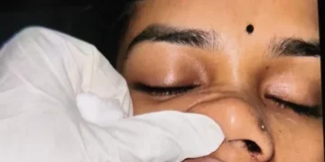 CG News : चलती कार में जमकर पथराव, कार सवार महिला बुरी तरह से जख्मी, एमपी जा रहा था परिवार