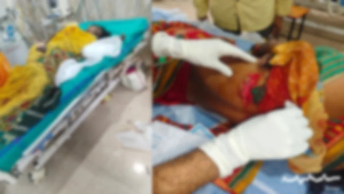 CG News : जंगली सूअर के हमले से 5 महिलाएं घायल, तेंदुपत्ता तोड़ने गई थी जंगल