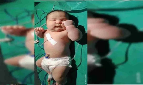CG News : मेकाज में जन्मा नन्हा दिग्गज, 5 किलो से अधिक वजन के नवजात ने डॉक्टरों को भी किया हैरान