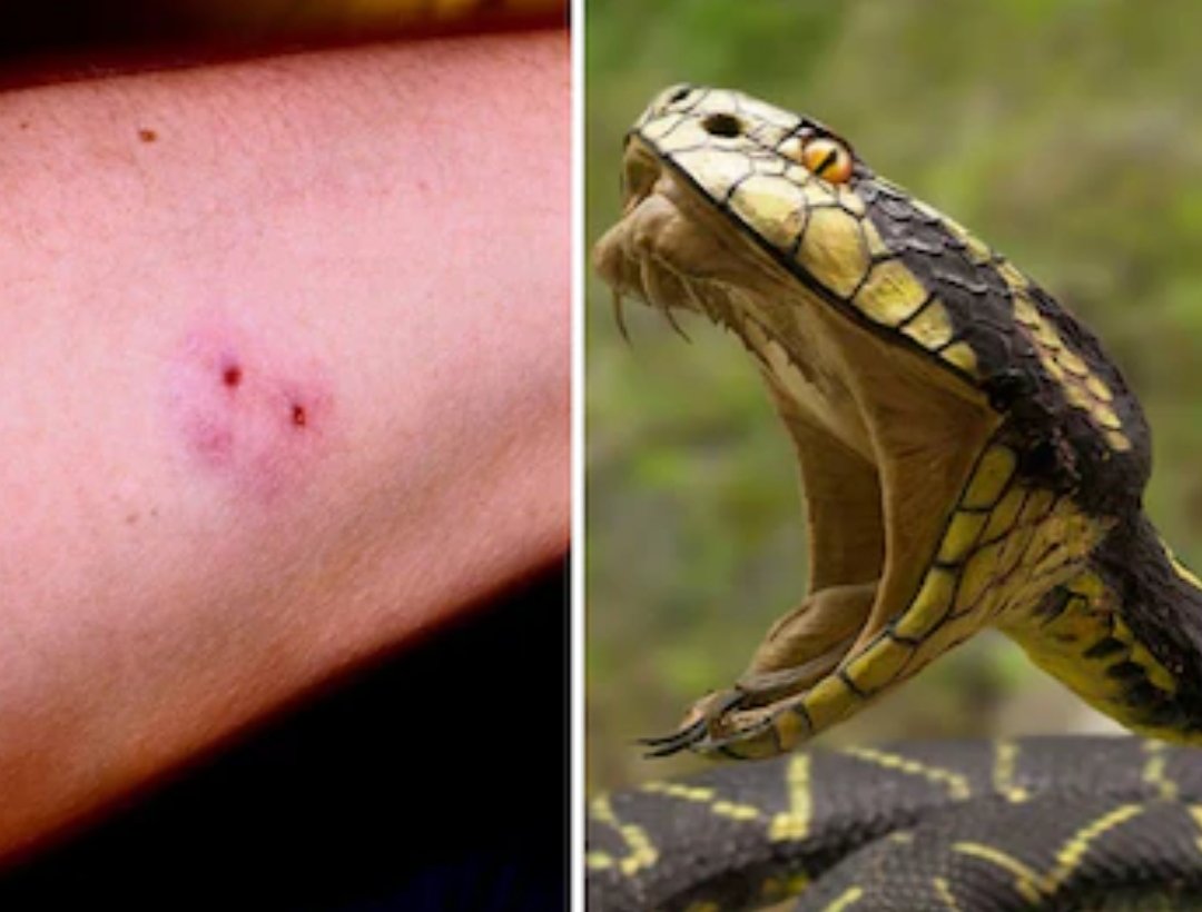 Snake Bite : एक ही युवक को सांप ने कई बार डसा, फिर भी कैसे बच गई जान, पढ़िए रहस्य से भरी ये खबर