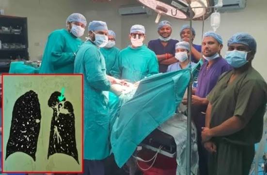 ​मेडिकल कॉलेज के हार्ट-चेस्ट और वैस्कुलर सर्जरी विभाग का एक और कीर्तिमान