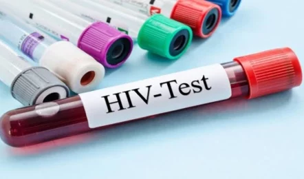 Sex Racket : सेक्स रैकेट चलाने वाली महिला निकली HIV पॉजिटिव पूरे शहर में मचा हड़कंप, संपर्क में आए लोगों की तलाशी शुरू