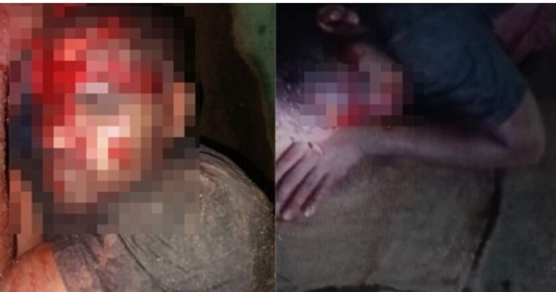 CG : आधी रात राहगीर युवक पर भालुओं के झुंड ने किया हमला
