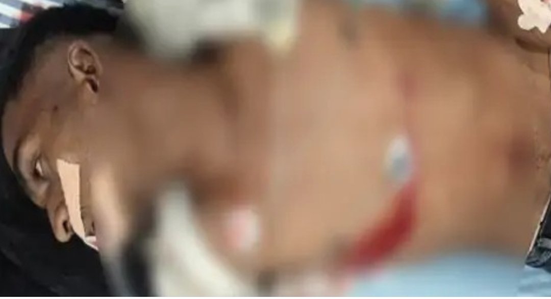 CG Crime : दुर्गा उत्सव मेले में चाकूबाजी से मचा हड़कंप, दो युवक घायल, एक के सिर पर गंभीर चोट, चार संदिग्ध हिरासत में