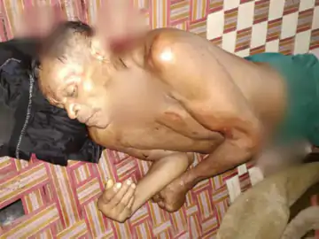 CG Crime : दुष्कर्म से भड़की नाबालिग, बुजुर्ग पर सब्बल से हमला कर हुई फरार